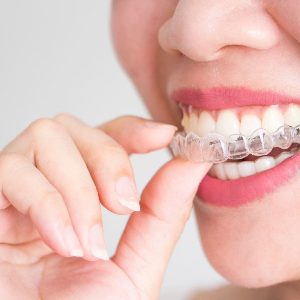 Ortodontia é na DentalRio, Clínica Odontológica na Barra da Tijuca
