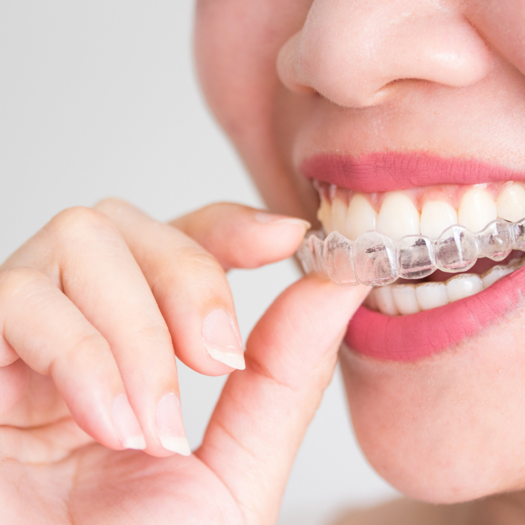 http://www.dentalrio.com.br/wp-content/uploads/2020/10/Invisalign-1-1024x1024.png